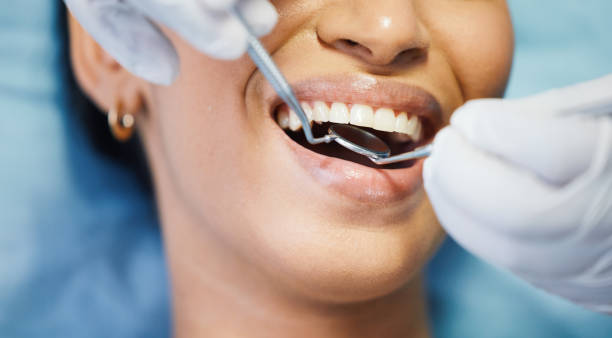 Best Emergency Dental Care for Sports Injuries in Tiltonsville, OH